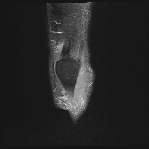 Click on the Serie image to view the images of Wieszt, Gnter